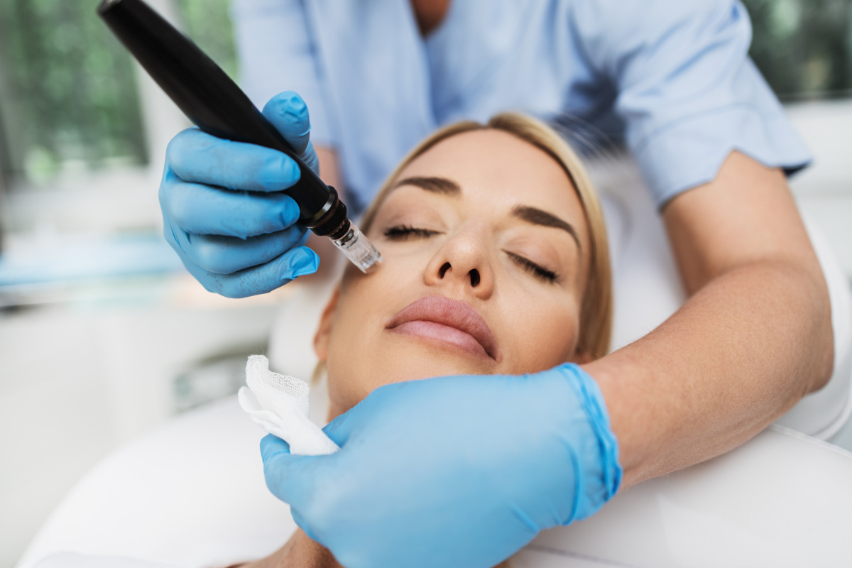 prp microneedling
