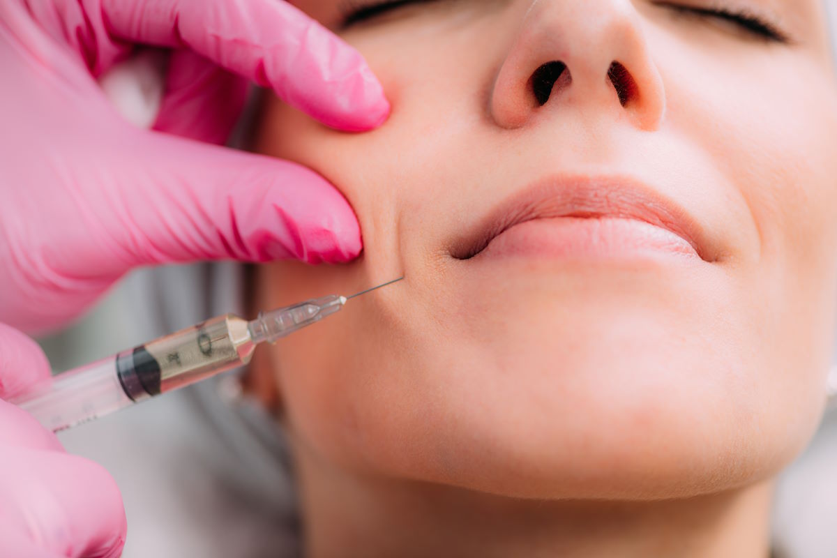 Facial Fillers in Buckeye, AZ