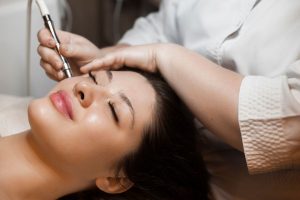 Microneedling Facial in Buckeye, AZ