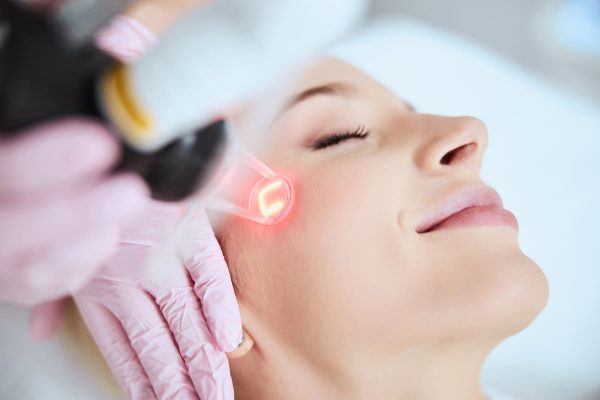 CO2 Laser Resurfacing in Verrado, AZ
