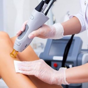Laser Hair Removal in Buckeye, AZ