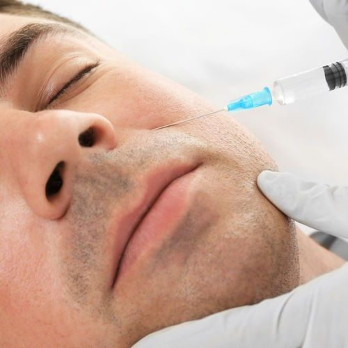 Bellafill Injections in Buckeye, AZ