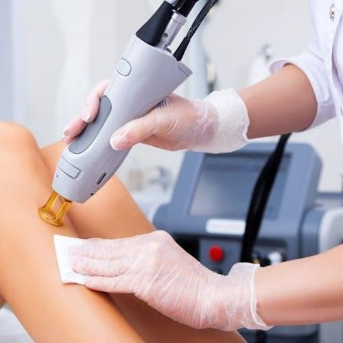 Laser Hair Removal in Buckeye, AZ