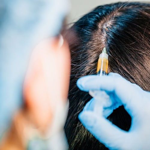 PRP Injections in Buckeye, AZ